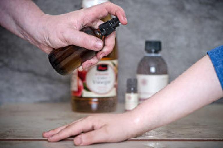 Summer skin care tips: home remedies for sunburn and more